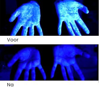 Wat zijn de veelvoorkomende ziekteverwekkers die worden aangetroffen in de poriën van de huid, en hoe kunnen ze worden geëlimineerd?