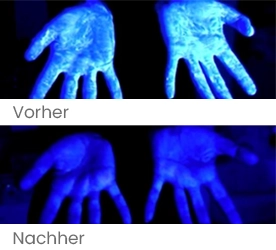 Schutz durch Benzalkoniumchlorid